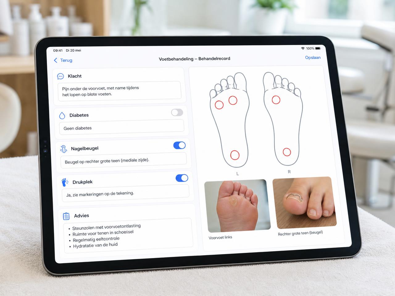 Ficha de tratamiento podológico en Boeked con esquema del pie, puntos de presión y fotos en tablet